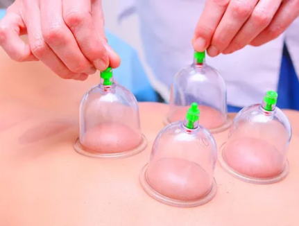 Min Chiropractic - CUPPING THERAPY